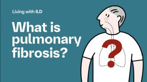 an animated video explaining pulmonary fibrosis